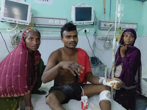 नवगछिया : बड़ा हादसा टला.. 11 हजार वोल्ट की चपेट में आने से झुलसा