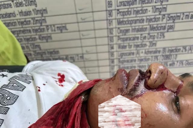 तलवारबाजी के दौरान खूनी संघर्ष